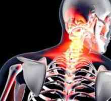 Zdravljenje ne-vretenčne artroze vratne hrbtenice