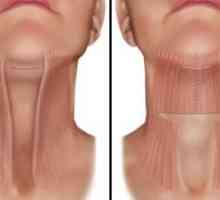 Metode dviganja vratu in brade ter njihove lastnosti