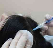 Mezoterapija za zdravljenje lasišča in rasti las