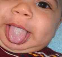 Zdravilo v ustih otroka: simptomi in zdravljenje
