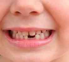 Otroški zobje: v kakšni starosti začnejo padati?