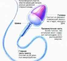 Morfologija spermograma: anomalije spermatozona in dekodiranje