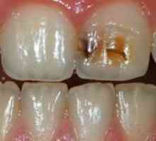 Nerazredne lezije zob: vrste in opis