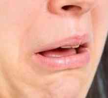 Neugoden okus v ustih: vzroki, simptomi in zdravljenje