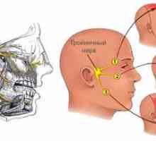 Neuritis trigeminalnega živca: simptomi in zdravljenje