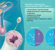 Norme za analizo spermograma pri moških in vzroke za nenormalnosti