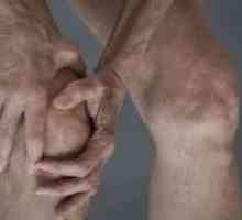 Značilnosti zdravljenja osteoartritisa kolena in njegovih simptomov