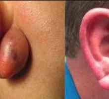 Kaj naredi komoro na uho v ušesu?