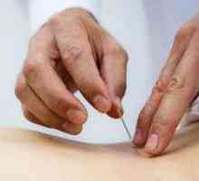 Pregledi akupunkture s kili v ledveni hrbtenici