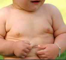 Debelost pri otrocih: simptomi in zdravljenje