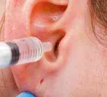 Vodikov peroksid za ušesa: samo čiščenje žveplovega čepa v ušesu