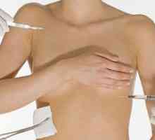 Plastična kirurgija dojke: glavne vrste operacij in koliko stane