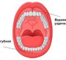 Plastični delček zgornje ustnice pri otroku: vrste in opis