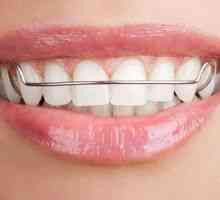 Plošče za poravnavo zob: ortodontska plošča
