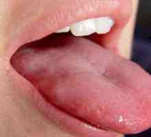 Zakaj je konica jezika bolna, kakšno zdravljenje je potrebno
