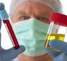 Pojav krvi v urinu moških. Vzroki, simptomi, zdravljenje