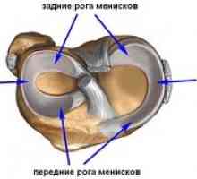 Poškodbe in zdravljenje meniskusa medialnega kolenskega sklepa