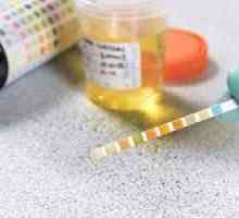 Povečana vsebnost beljakovin v urinu, kaj to pomeni?