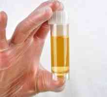 Vzroki mokrega urin pri moških in ženskah