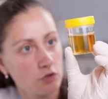 Vzroki za pojav sluznice v urinu pri ženskah