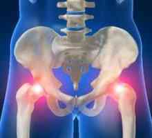 Vzroki vnetja kolčnega sklepa: simptomi in zdravljenje