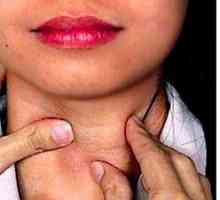 Simptomi bolezni ščitnice in metode zdravljenja žensk
