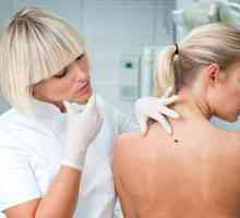 Akne na hrbtu: vzroki za pojav pri ženskah in zdravljenje