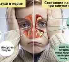 Psihosomatika prehlada, zastoja nosu in sinuzitisa