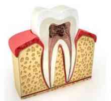 Zguba zoba, njegova struktura, funkcije in metode zdravljenja