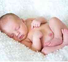 Umbilična kila pri novorojenčkih: vzroki in simptomi