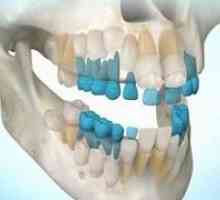 Regeneracija zob: ali je mogoče, tehnologije gojenja