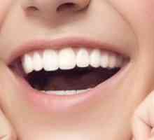 Remineralizacija zob doma: indikacije