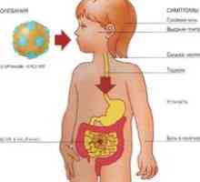 Rotavirusna okužba: simptomi in zdravljenje. Rotavirus pri otrocih