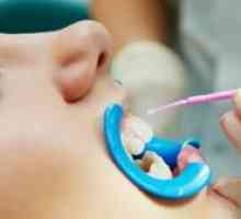 Srebrenje zob pri otrocih: za in proti