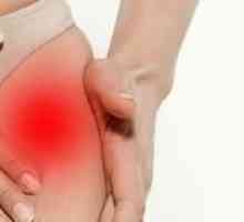 Simptomi in zdravljenje hipnega artritisa