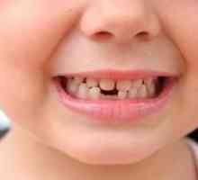 Koliko otroških zob imajo otroci?