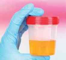 Soli oksalat v urinu otroka