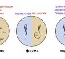 Spermogramma za moške: kako vzeti spermogram