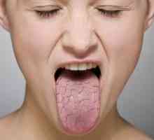 Sušenje v grlu: vzroki in zdravljenje