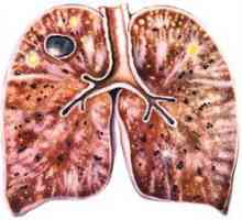 Tuberkuloza: kako se lahko prenašajo, prenosne poti in simptomi
