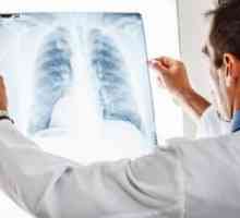 Tuberkuloza: boj proti tuberkulozni bakteriji, palici kocha