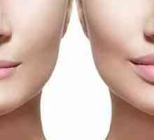 Lepotne injekcije: širjenje ustnic z Botoxom