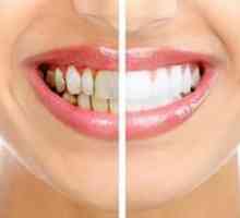 Izločanje zobne plošče doma: metode in priporočila