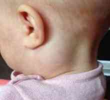Razširjene bezgavke v vratu otroka - razlogi za videz