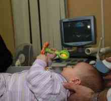 Ultrazvok možganov pri novorojenčkih