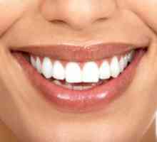 Kabelsko zobje zob z periodontalnimi boleznimi