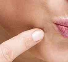 Vrste in metode zdravljenja fibroidne kože