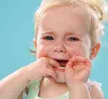 Virusni stomatitis pri otrocih: simptomi in zdravljenje