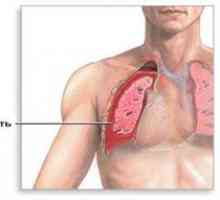 Voda v pljučih: vzroki, posledice, zdravljenje