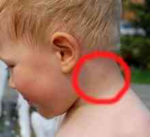 Limfni vozli na otrokovem vratu so bili vnetljivi: vzroki in zdravljenje